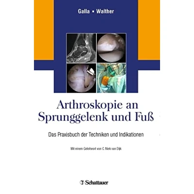 Abbildung von Arthroskopie an Sprunggelenk und Fuß: Das Praxisbuch der Techniken Indikationen