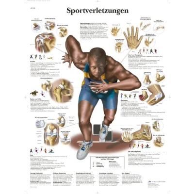 Abbildung von 3B Scientific Lehrtafel laminiert Sportverletzungen