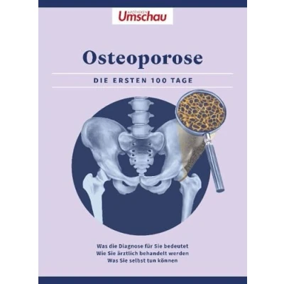Abbildung von Apotheken Umschau: Osteoporose: die ersten 100 Tage. Was Diagnose bedeutet Wie Sie ärztlich behandelt werden selbst tun können (Die Buchreihe der Umschau)
