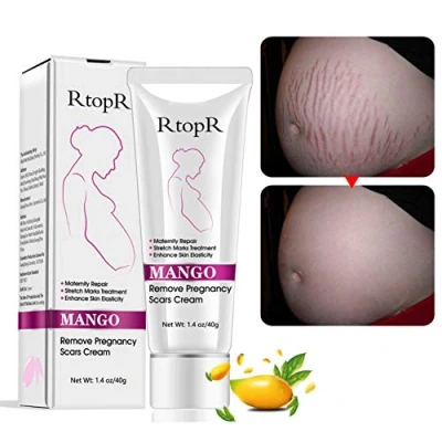 Abbildung von Stretch Marks Cream Narbencreme, Narbencreme Entfernung Creme, Körper Reparatur Creme Dehnungsstreifen Haut Moisturzing für Frauen nach Schwangerschaft,40g