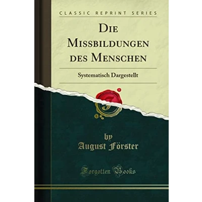 Abbildung von Die Missbildungen des Menschen (Classic Reprint): Systematisch Dargestellt: Dargestellt Reprint)