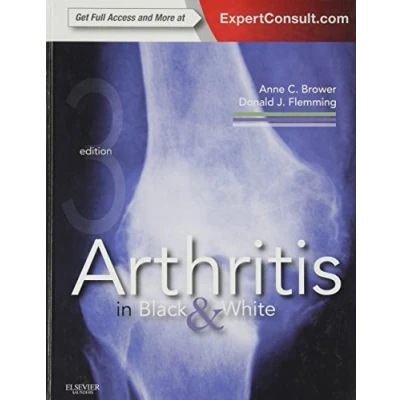 Abbildung von Arthritis in Black and White: Expert Consult Online Print