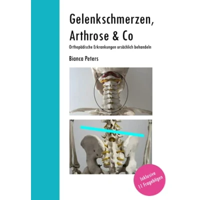 Abbildung von Gelenkschmerzen, Arthrose &amp; Co: Orthopädische Erkrankungen ursächlich behandeln
