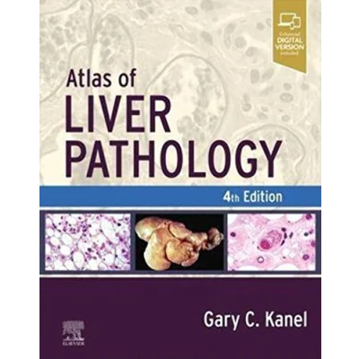 Abbildung von Atlas of Liver Pathology (Atlas Surgical Pathology)