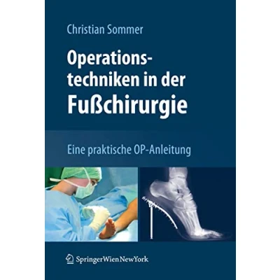 Abbildung von Operationstechniken in der Fußchirurgie: Eine praktische OP Anleitung