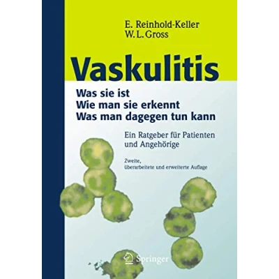 Abbildung von Vaskulitis: Was ist sie Wie man erkennt dagegen tun kann
