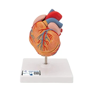Abbildung von 3B Scientific Menschliche Anatomie Klassik Herzmodell mit linksventrikulärer Hypertrophie (LVH), 2 teilig + kostenlose App Smart Anatomy, G04