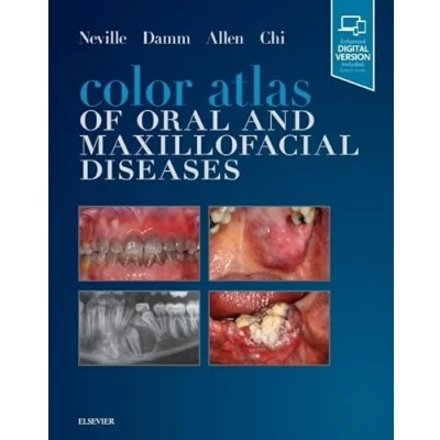 Abbildung von Color Atlas of Oral and Maxillofacial Diseases: Enhanced Digital Version Included. Details inside