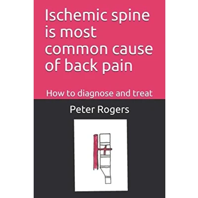 Abbildung von Ischemic spine is most common cause of back pain: How to diagnose and treat