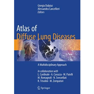 Abbildung von Atlas of Diffuse Lung Diseases: A Multidisciplinary Approach