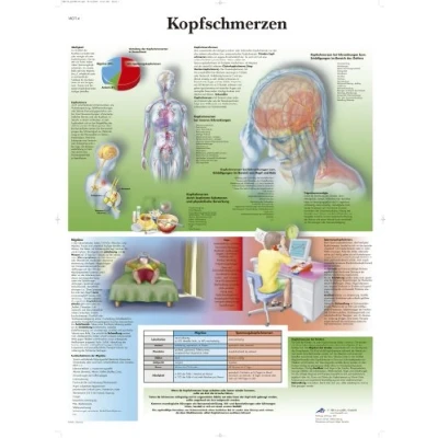 Abbildung von 3B Scientific Lehrtafel laminiert Kopfschmerzen