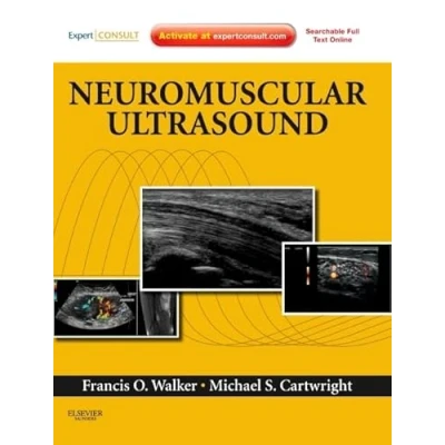 Abbildung von Neuromuscular Ultrasound: Expert Consult Online and Print