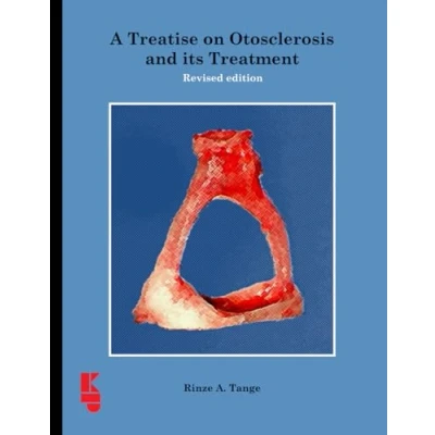 Abbildung von A Treatise on Otosclerosis and its Treatment: Revised edition