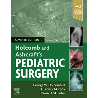 Abbildung von Holcomb and Ashcraft&#039;s Pediatric Surgery: Expert Consult Online + Print
