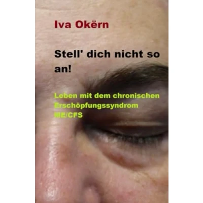 Abbildung von Stell dich nicht so an! Leben mit dem chronischen Erschöpfungssyndrom ME /CFS