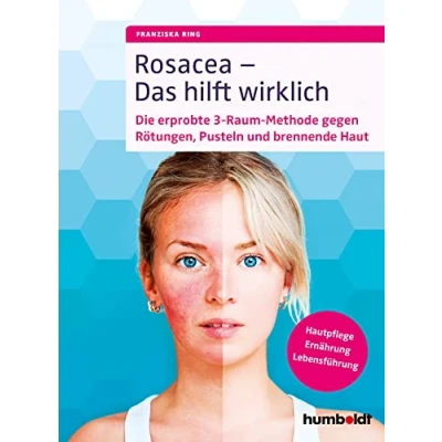 Abbildung von Rosacea Das hilft wirklich: Die erprobte 3 Raum Methode gegen Rötungen, Pusteln und brennende Haut, Hautpflege, Ernährung, Lebensführung