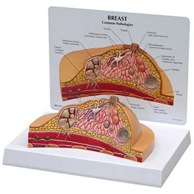 Abbildung von GPI Anatomicals W33351 Brust Modell Querschnitt