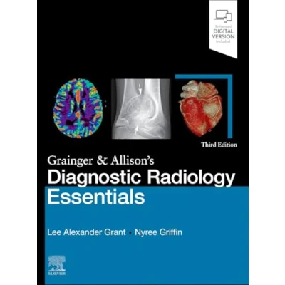 Abbildung von Grainger &amp; Allison&#039;s Diagnostic Radiology Essentials: Expert Consult: Online and Print