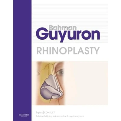 Abbildung von Rhinoplasty: Expert Consult Premium Edition Enhanced Online Features and Print