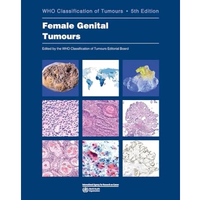 Abbildung von Female Genital Tumours: Who Classification of Tumours (Who Tumours, 4, Band 4)