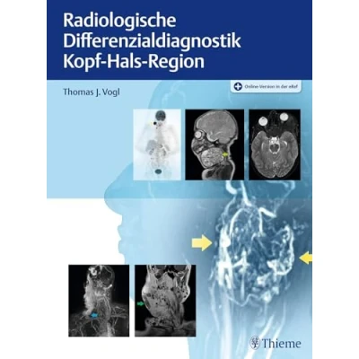 Abbildung von Radiologische Differenzialdiagnostik Kopf Hals Region
