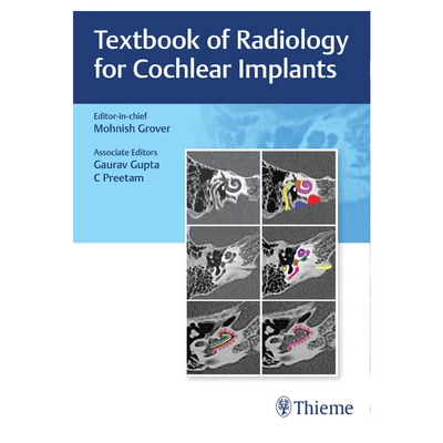 Abbildung von Textbook of Radiology for Cochlear Implants