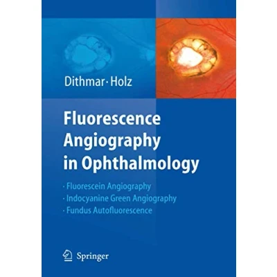 Abbildung von Fluorescence Angiography in Ophthalmology: Fluorescein Angiography, Indocyanine Green Fundus Autofluorescence