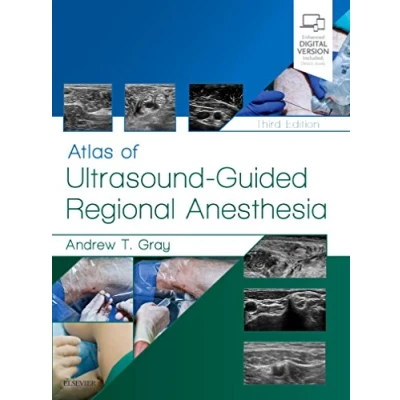 Abbildung von Atlas of Ultrasound Guided Regional Anesthesia: Expert Consult Online and Print
