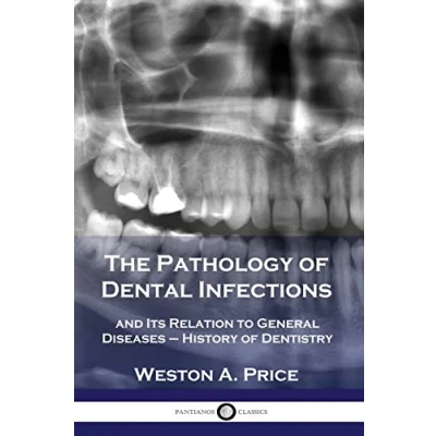 Abbildung von The Pathology of Dental Infections: and Its Relation to General Diseases History Dentistry