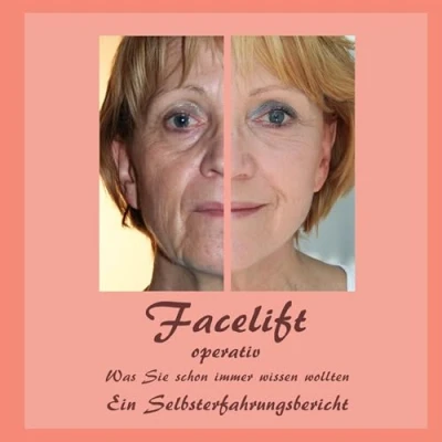 Abbildung von Facelift operativ: Was Sie schon immer wissen wollten Ein Selbsterfahrungsbericht