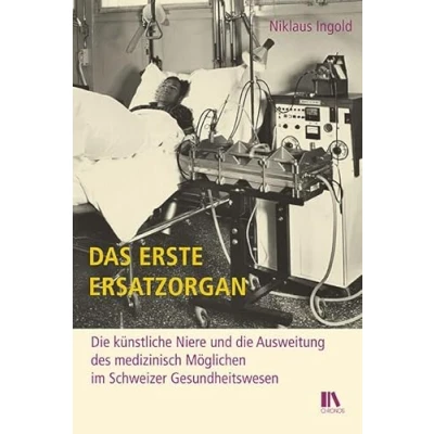 Abbildung von Das erste Ersatzorgan: die künstliche Niere und Ausweitung des medizinisch Möglichen im Schweizer Gesundheitswesen