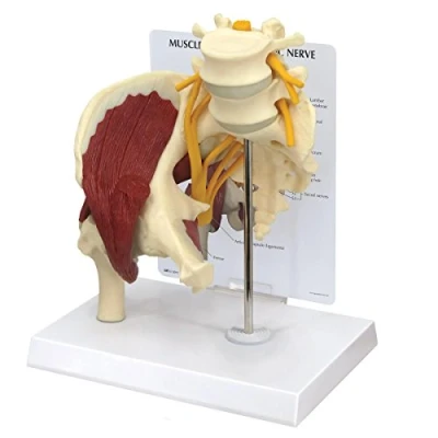 Abbildung von GPI Anatomicals 1311 Hüfte mit Muskeln und Ischiasnerv