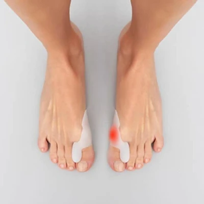 Abbildung von InnovaGoods® Silikon Bunion Korrektor, 2er Pack, lindert Schmerzen und Unannehmlichkeiten von Hallux Valgus, diskretes bequemes Design, ideal für den täglichen Gebrauch.