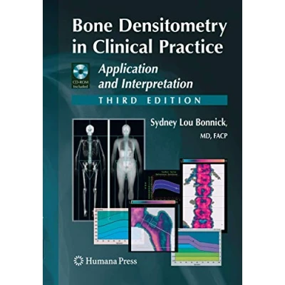 Abbildung von Bone Densitometry in Clinical Practice: Application and Interpretation (Current Practice)