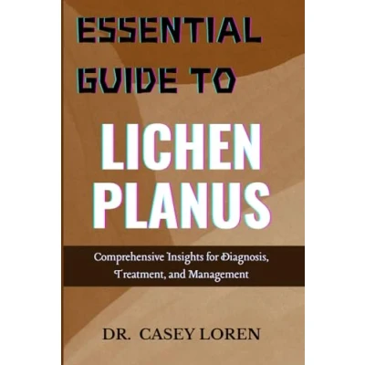 Abbildung von ESSENTIAL GUIDE TO LICHEN PLANUS: Comprehensive Insights for Diagnosis, Treatment, and Management
