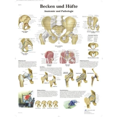 Abbildung von 3B Scientific Lehrtafel Becken und Hüfte Anatomie Pathologie, VR0172UU
