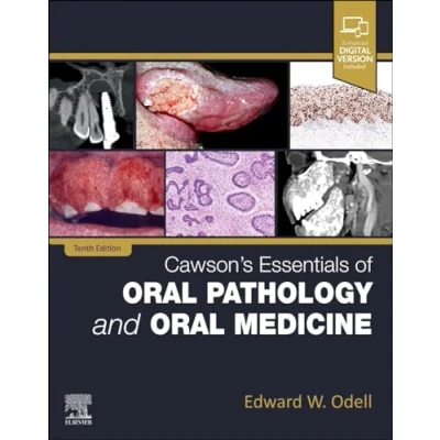 Abbildung von Cawson&#039;s Essentials of Oral Pathology and Medicine