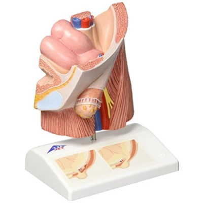 Abbildung von 3B Scientific Menschliche Anatomie Leistenbruchmodell + kostenlose App Smart Anatomy