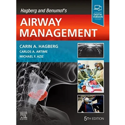 Abbildung von Hagberg and Benumof&#039;s Airway Management