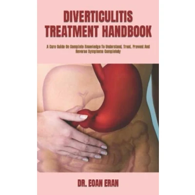 Abbildung von DIVERTICULITIS TREATMENT HANDBOOK: A Cure Guide On Complete Knowledge To Understand, Treat, Prevent And Reverse Symptoms Completely
