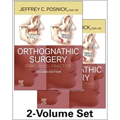 Abbildung von Orthognathic Surgery 2 Volume Set: Principles and Practice