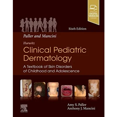 Abbildung von Paller and Mancini Hurwitz Clinical Pediatric Dermatology: A Textbook of Skin Disorders Childhood &amp; Adolescence