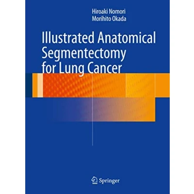 Abbildung von Illustrated Anatomical Segmentectomy for Lung Cancer