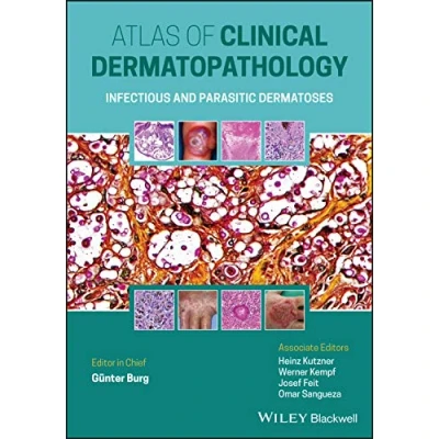 Abbildung von Atlas of Clinical Dermatopathology: Infectious and Parasitic Dermatoses
