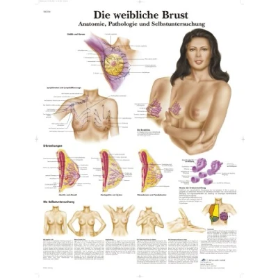 Abbildung von 3B Scientific Lehrtafel laminiert Die weibliche Brust Anatomie, Pathologie und Selbstuntersuchung