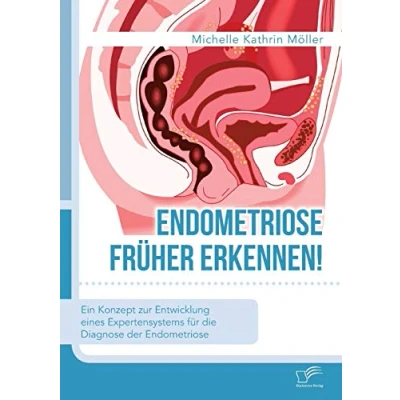 Abbildung von Endometriose früher erkennen! Ein Konzept zur Entwicklung eines Expertensystems für die Diagnose der
