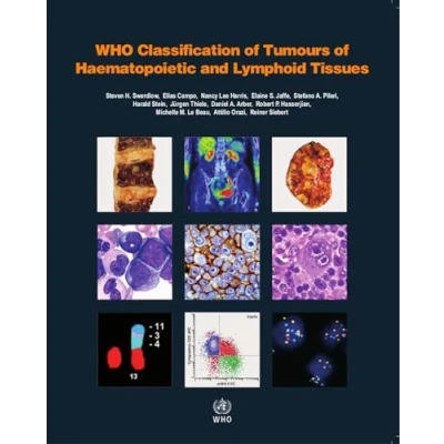 Abbildung von WHO Classification of Tumours Haematopoietic and Lymphoid Tissues: Vol. 2 (World Health Organization Tumours, Band 2)
