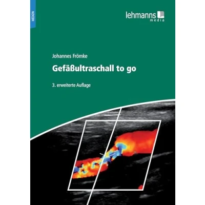 Abbildung von Gefäßultraschall to go
