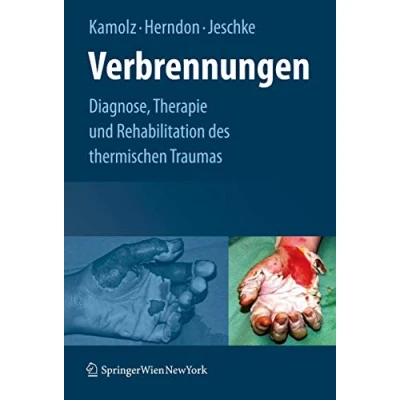 Abbildung von Verbrennungen: Diagnose, Therapie und Rehabilitation des thermischen Traumas