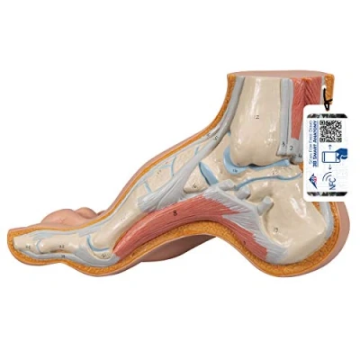 Abbildung von 3B Scientific Menschliche Anatomie Modell Hohlfuß (Pes cavus) + kostenlose App Smart Anatomy, M32